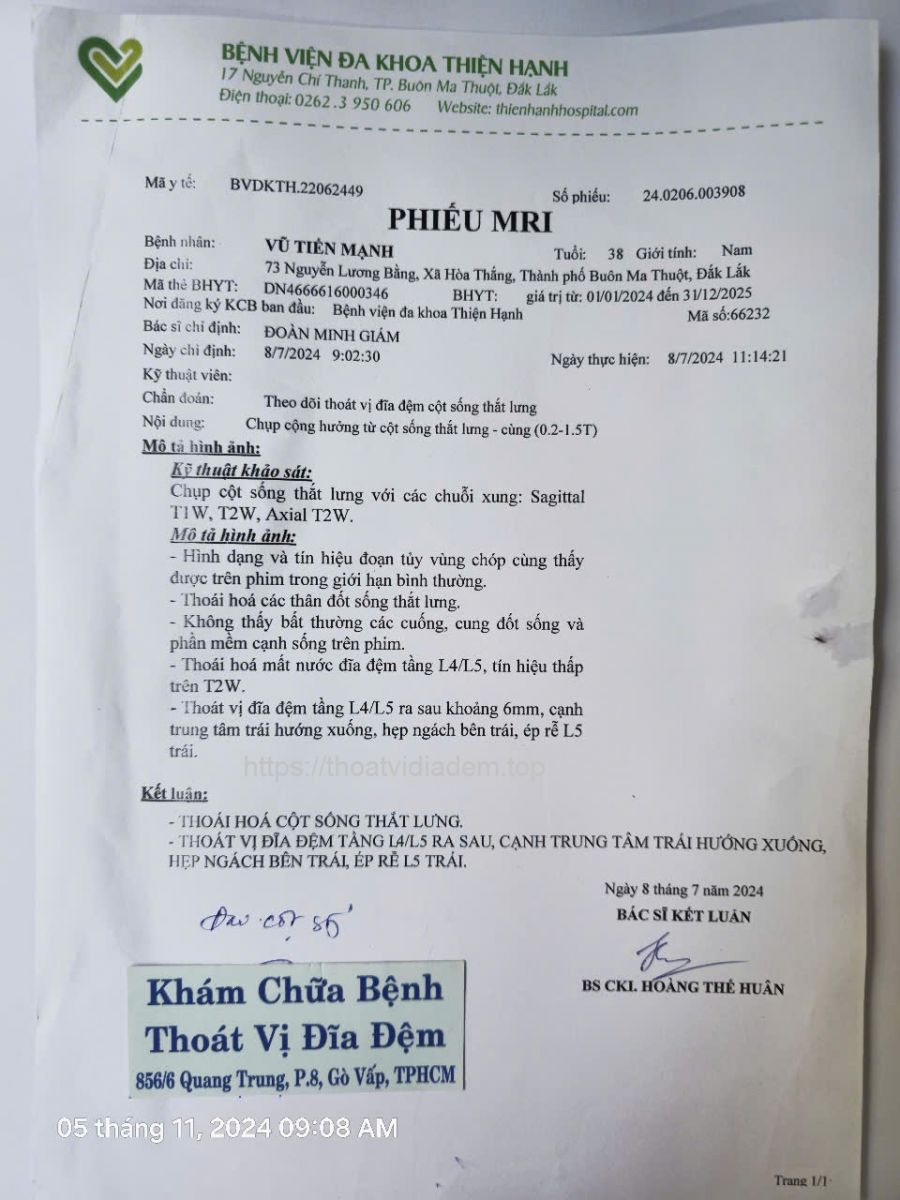 Thoát vị đĩa đệm L4 L5